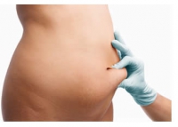 Come modificare i "pieni" e i "vuoti" della nostra silhouette : liposuzione e lipofilling